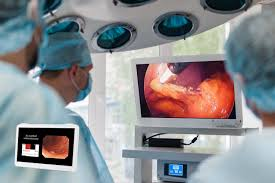 Benefits of Minimally Invasive Endoscopy: A Comprehensive Guide